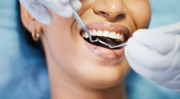 Best Emergency Tooth Extraction in New Hartford Center, CT